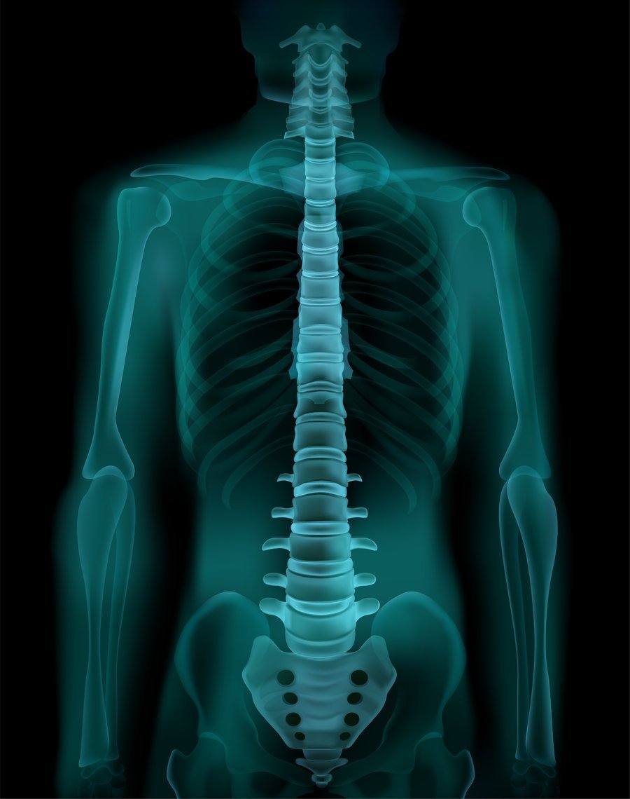 Spine X-ray, illustrative